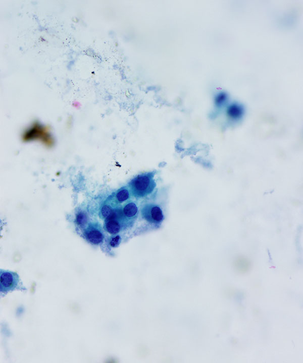 03 : Adrenal Gland Normal Adrenal Gland