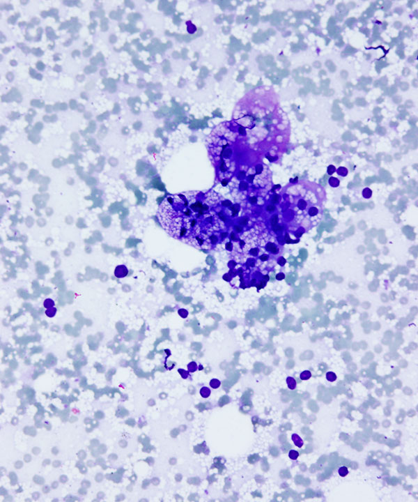 05 : Adrenal Gland Normal Adrenal Gland