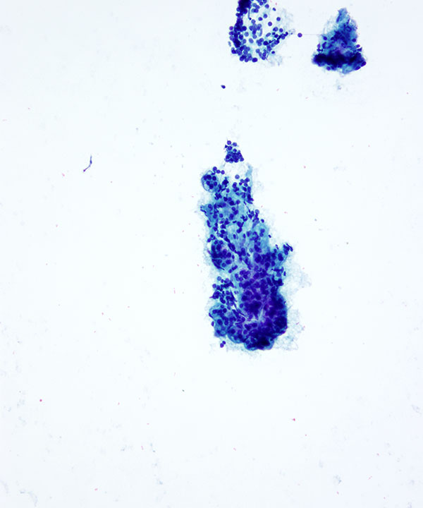 07 : Adrenal Gland Normal Adrenal Gland