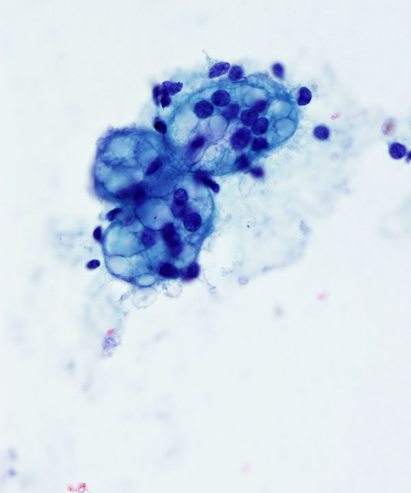 08 : Adrenal Gland Normal Adrenal Gland