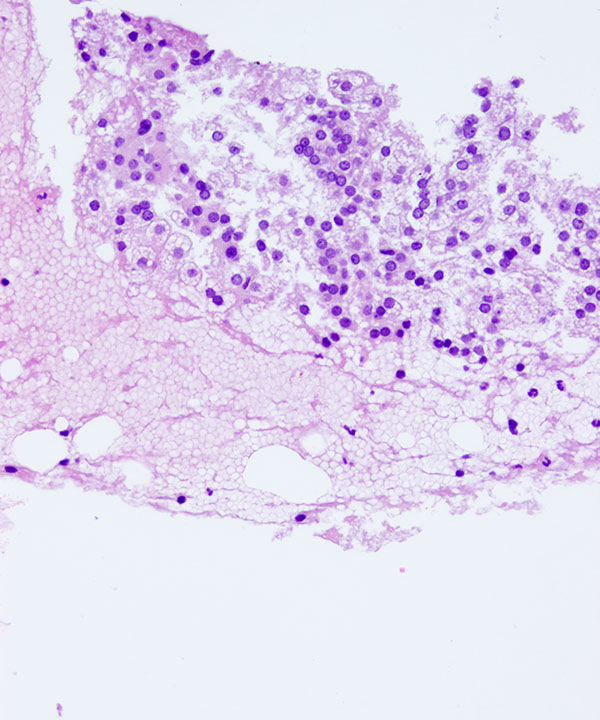 09 : Adrenal Gland Normal Adrenal Gland
