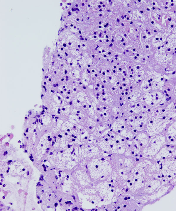 10 : Adrenal Gland Normal Adrenal Gland