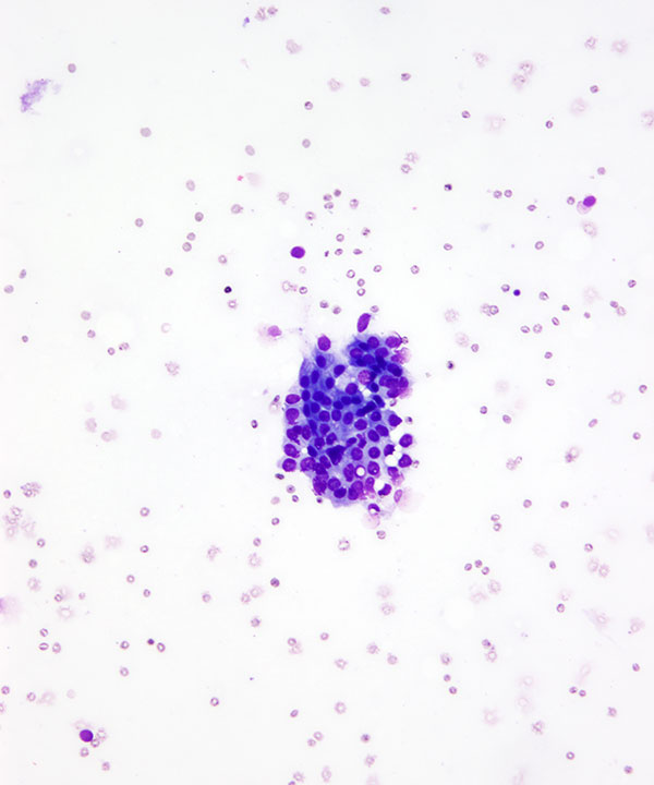 2 : Breast Benign Ductal Cells