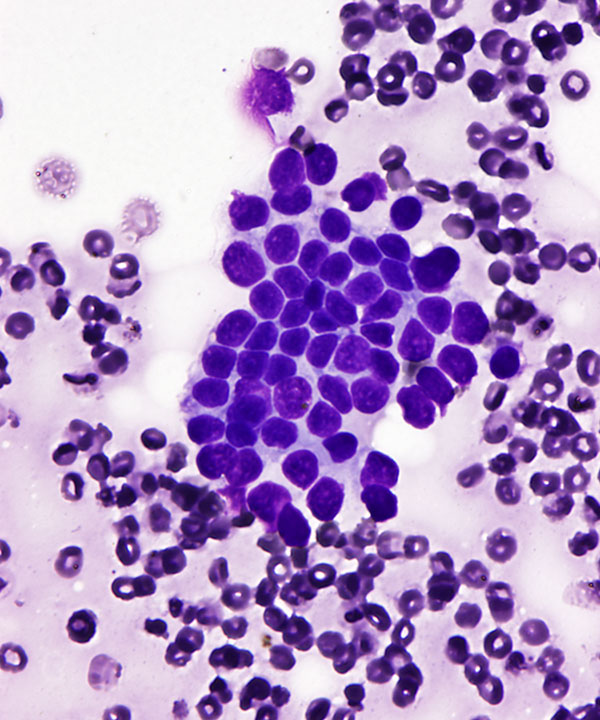 3 : Breast Benign Ductal Cells