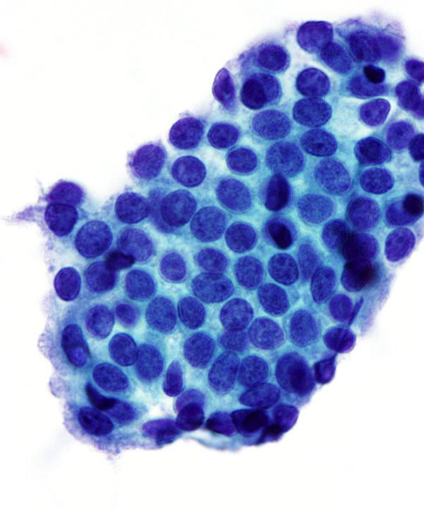 6 : Breast Benign Ductal Cells