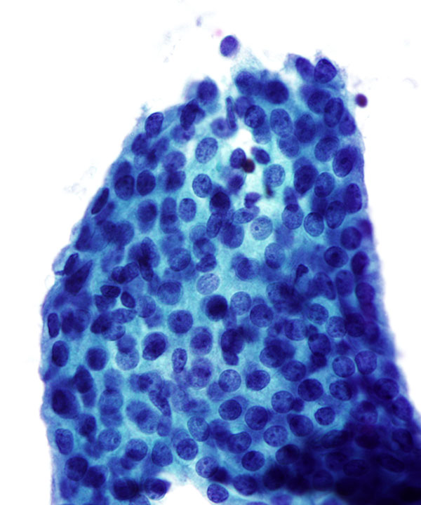 7 : Breast Benign Ductal Cells
