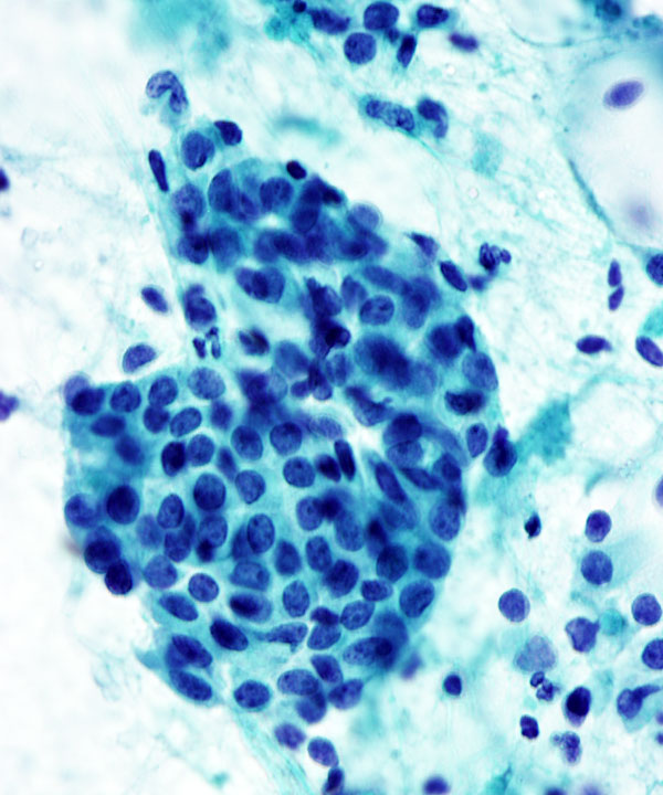 8 : Breast Benign Ductal Cells