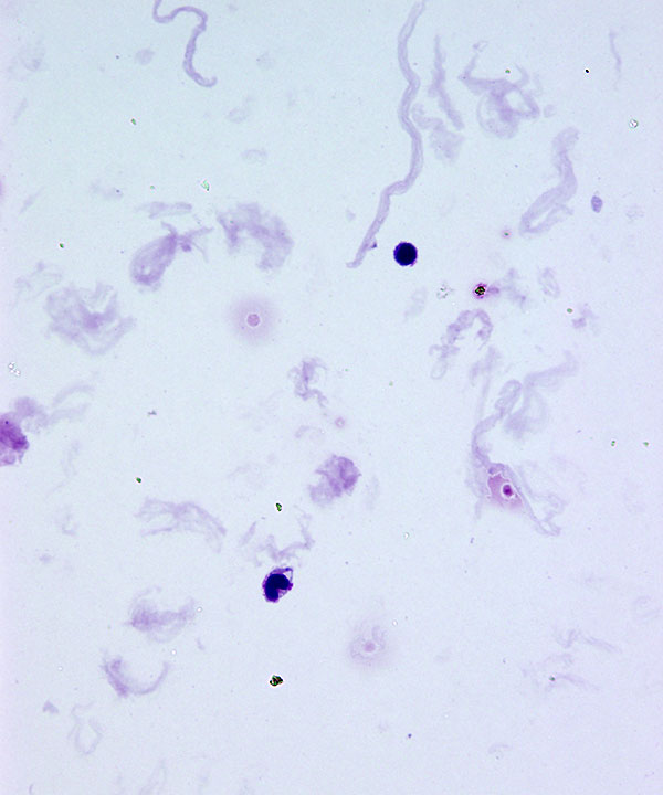 01 : Normal CSF