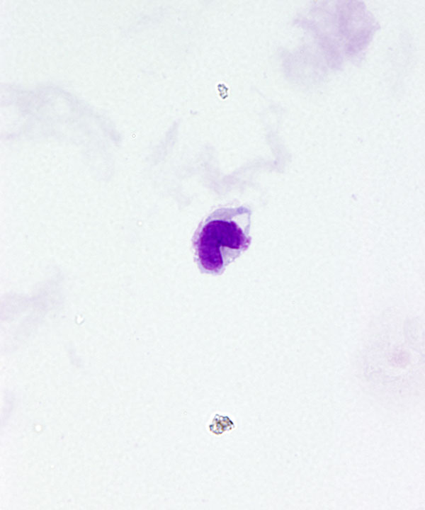 04 : Normal CSF