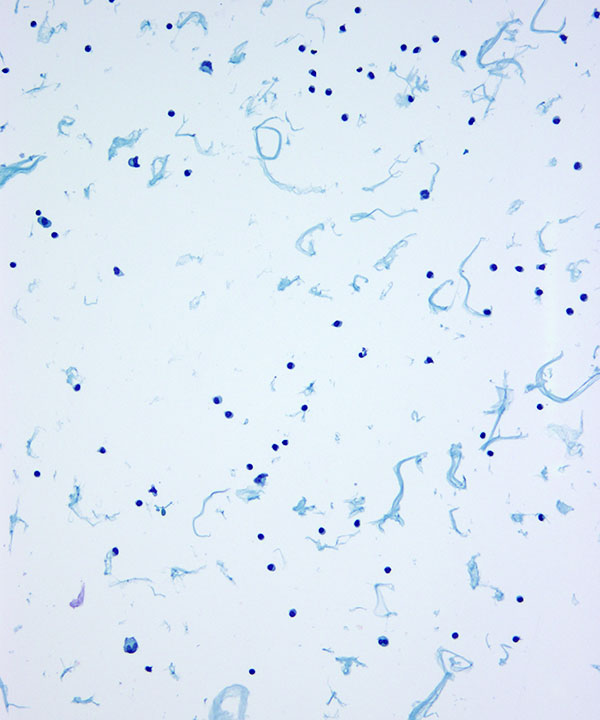05 : Normal CSF