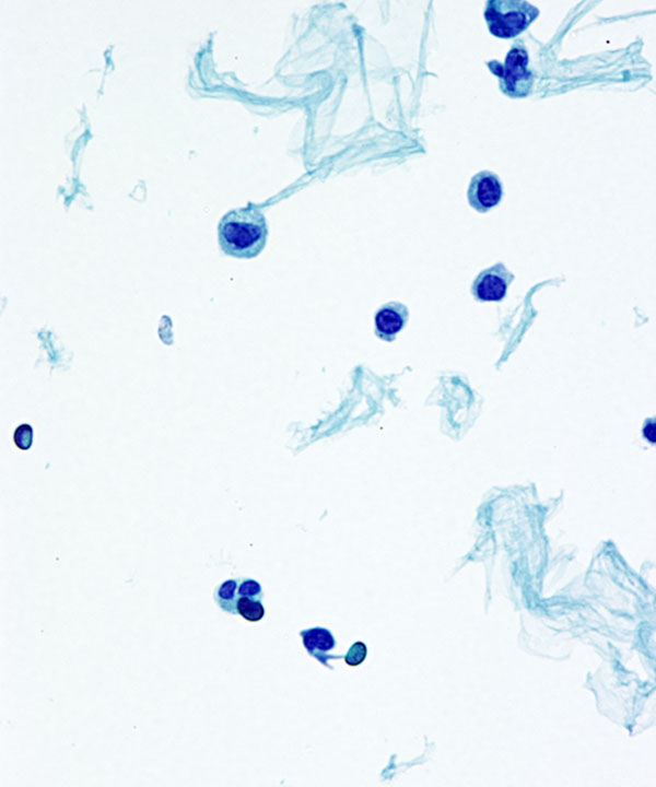 06 : Normal CSF