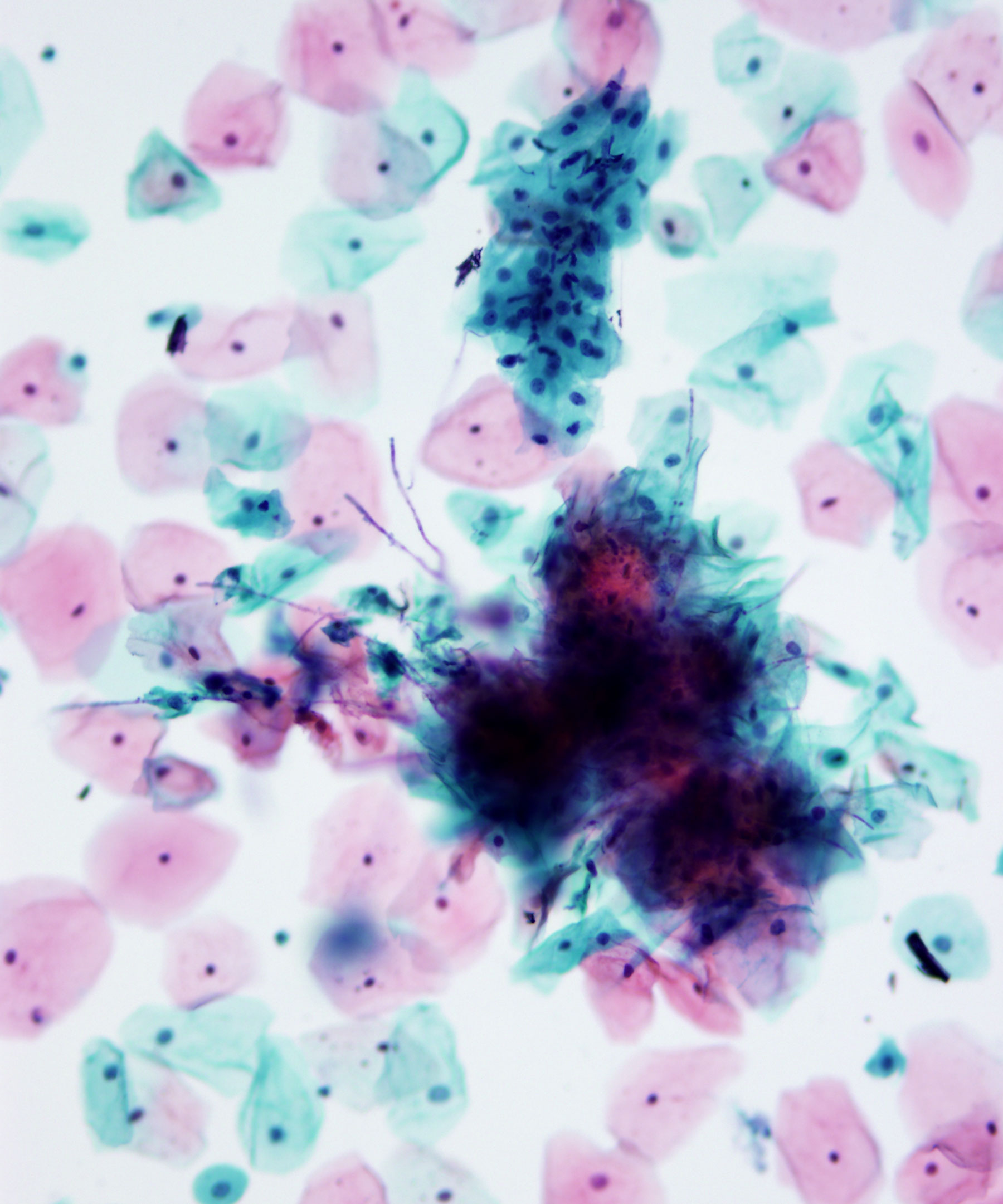 image showing 'Candida'