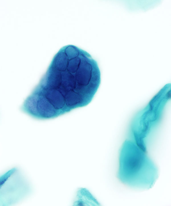 image showing 'Herpes Virus'