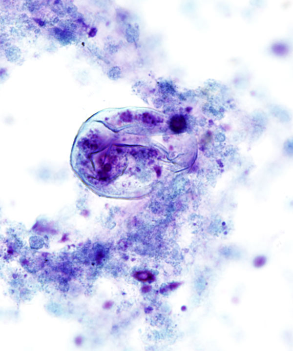 3 :  Infectious Diseases Coccidiodomycosis
