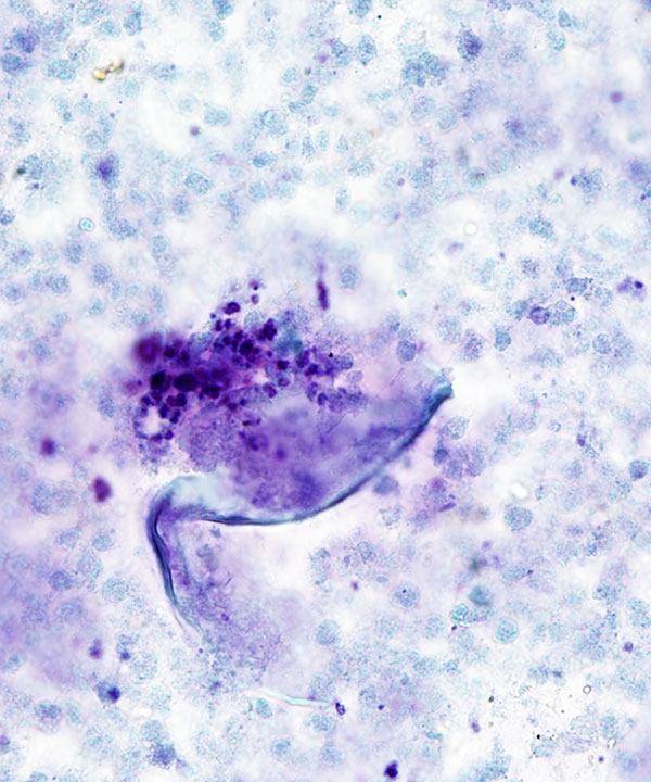 4 :  Infectious Diseases Coccidiodomycosis