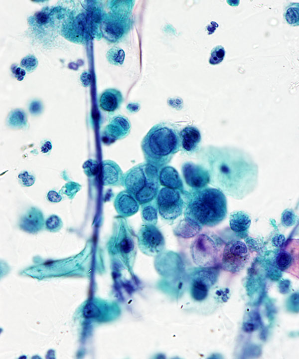 04 :  Infectious Diseases Herpes Virus Infection