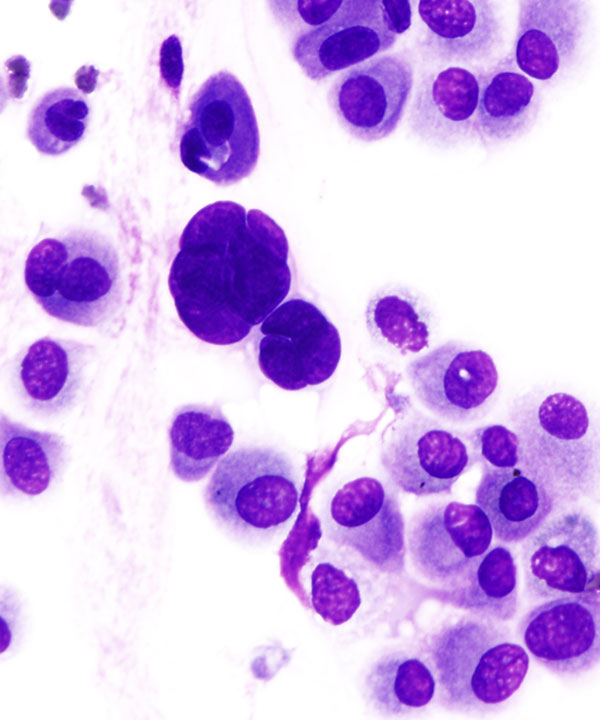 2 :  Infectious Diseases Adenovirus Infections