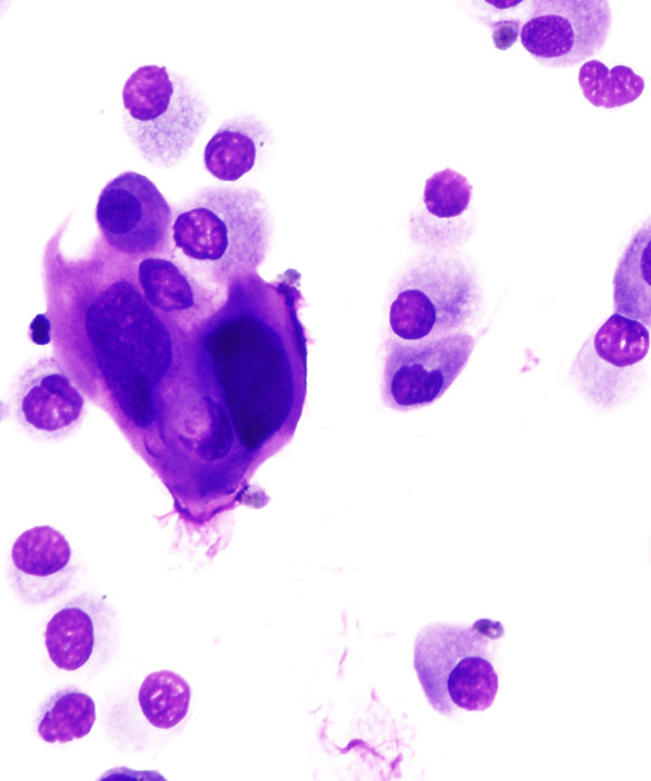 3 :  Infectious Diseases Adenovirus Infections