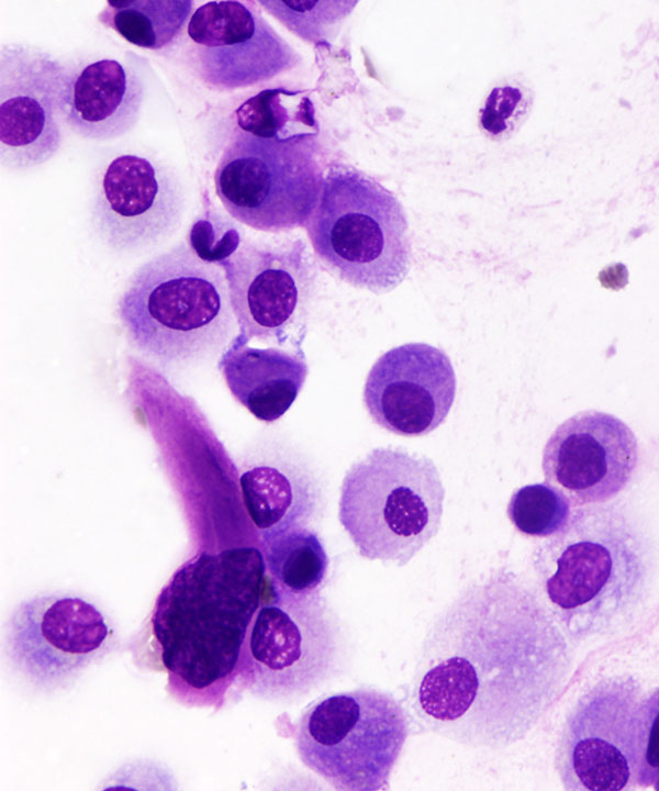 4 :  Infectious Diseases Adenovirus Infections