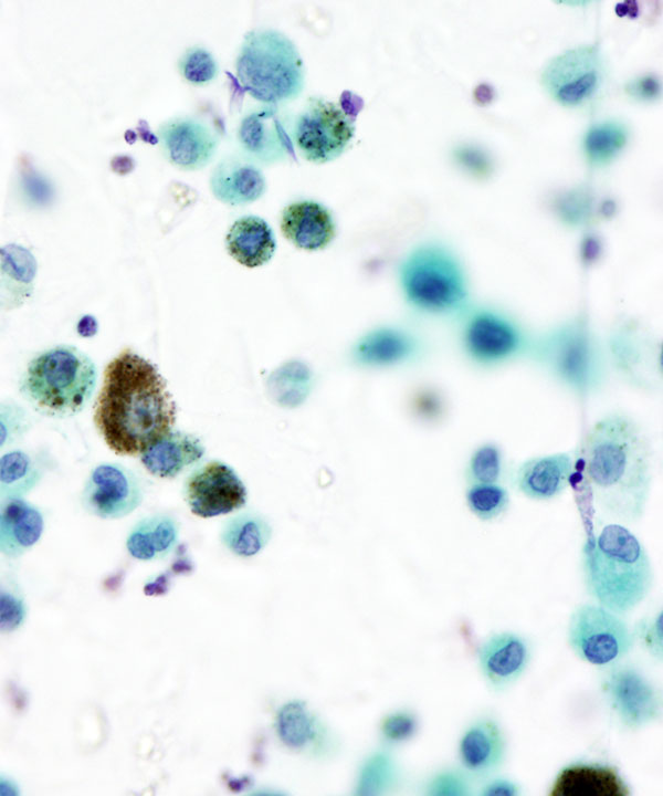 4 :  Infectious Diseases Cytomegalovirus Infection