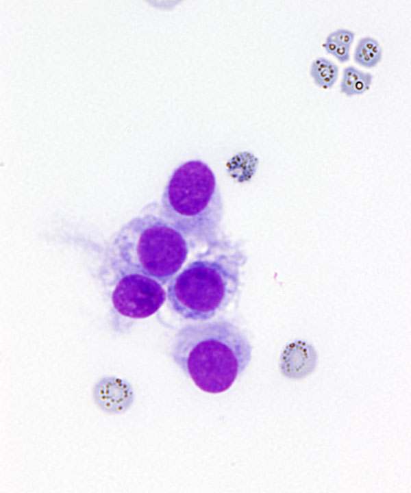 03 : Kidney Normal Kidney