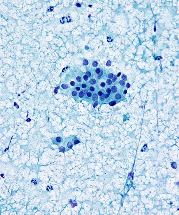 04 : Kidney Normal Kidney
