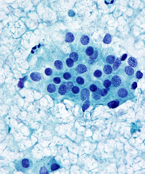 06 : Kidney Normal Kidney