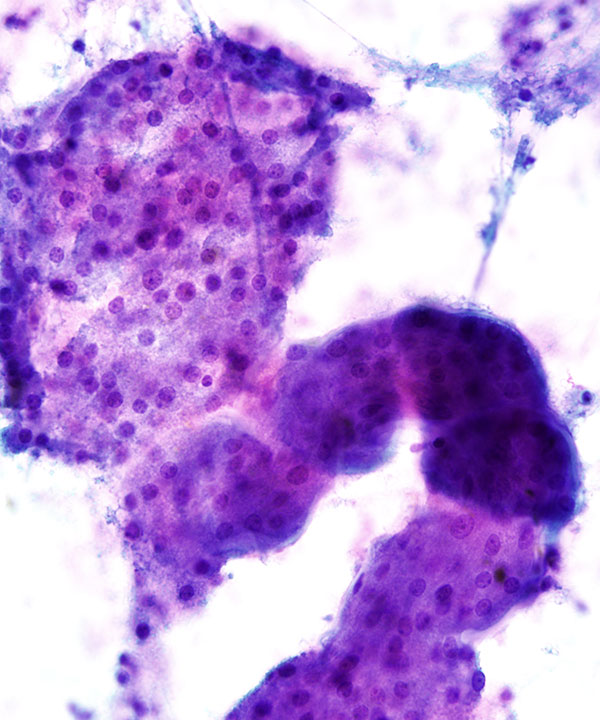07 : Kidney Normal Kidney