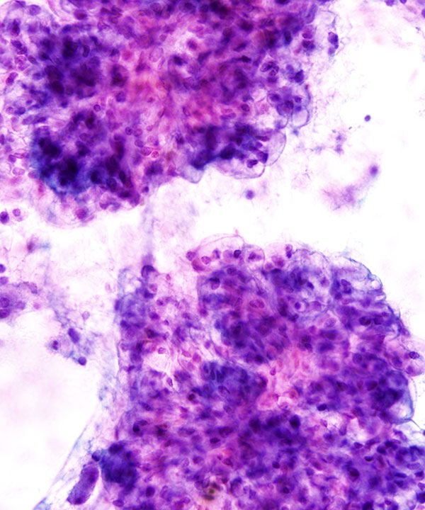 09 : Kidney Normal Kidney