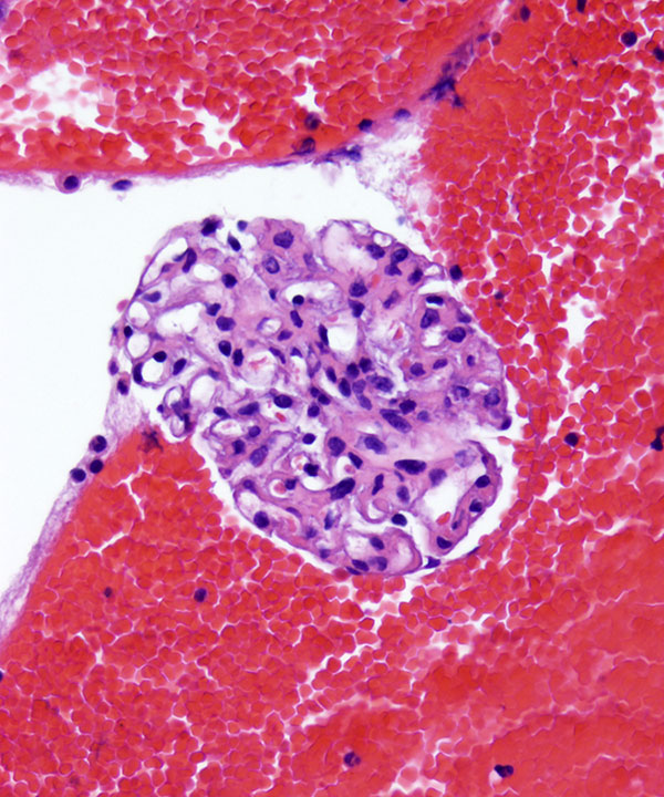 11 : Kidney Normal Kidney