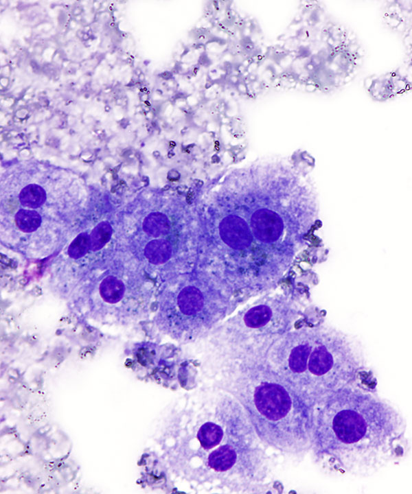 02 : Liver Normal Liver