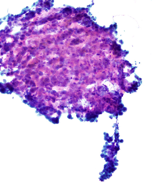 03 : Liver Normal Liver