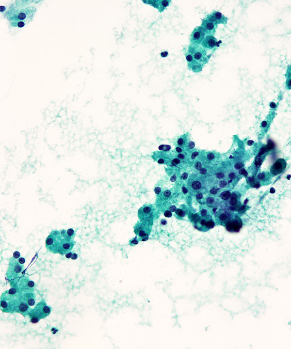 04 : Liver Normal Liver
