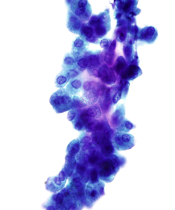 05 : Liver Normal Liver