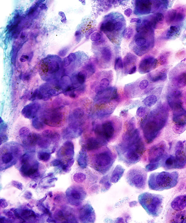06 : Liver Normal Liver