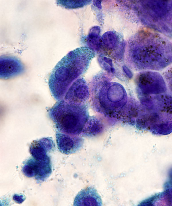 07 : Liver Normal Liver