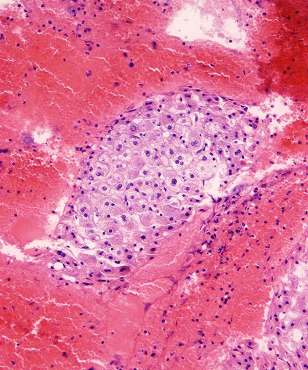 08 : Liver Normal Liver