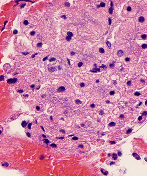 09 : Liver Normal Liver