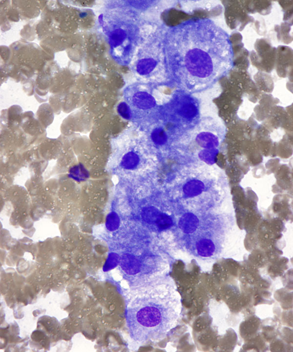 10 : Liver Normal Liver
