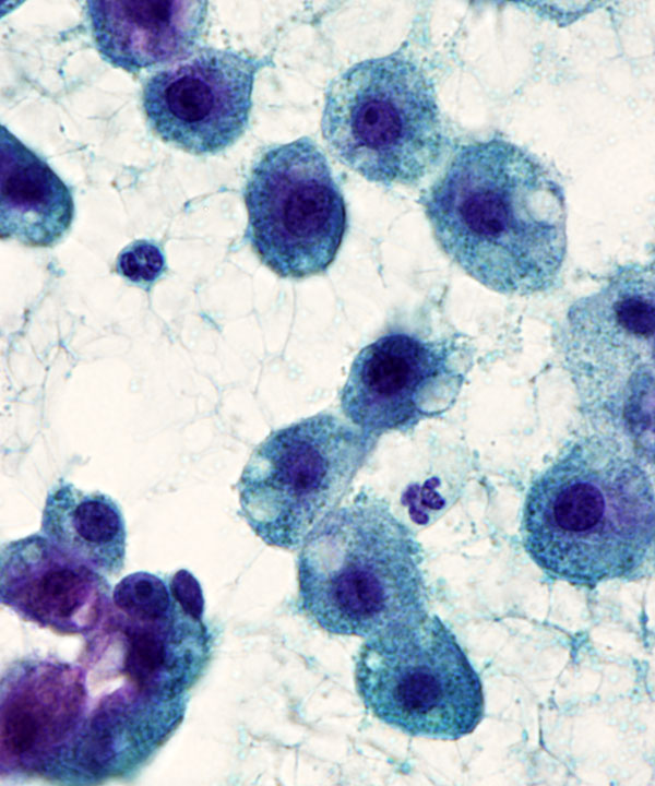 11 : Liver Normal Liver
