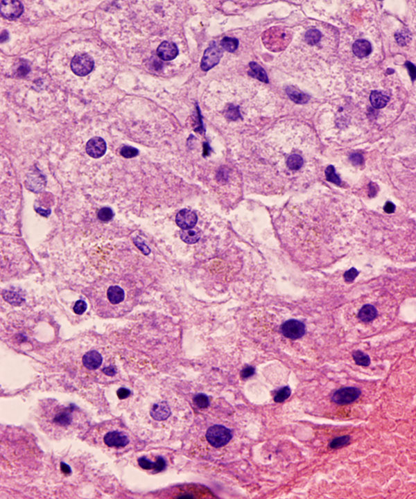 13 : Liver Normal Liver