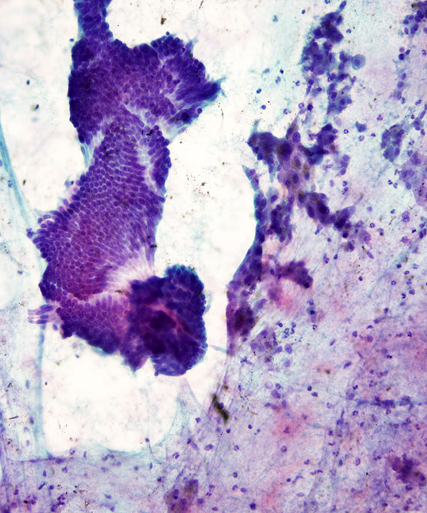15 : Liver Normal Liver