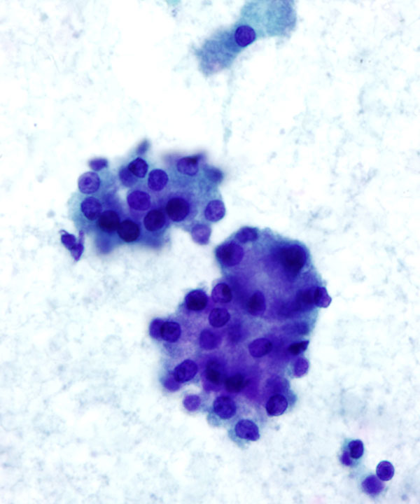 03 : Normal Pancreas Acinar Cells