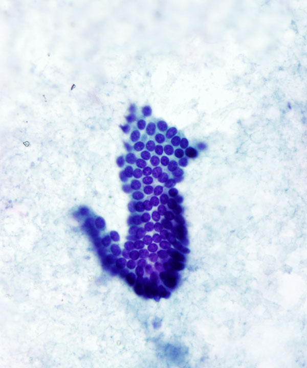 02 : Normal Pancreas Ductal Cells