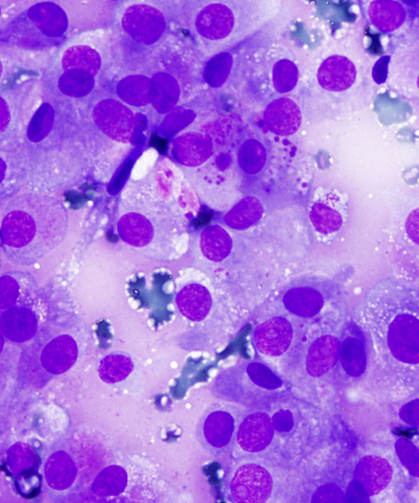 03 : Salivary Gland MASC