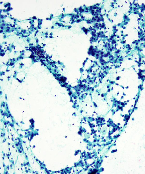 06 : Salivary Gland MASC