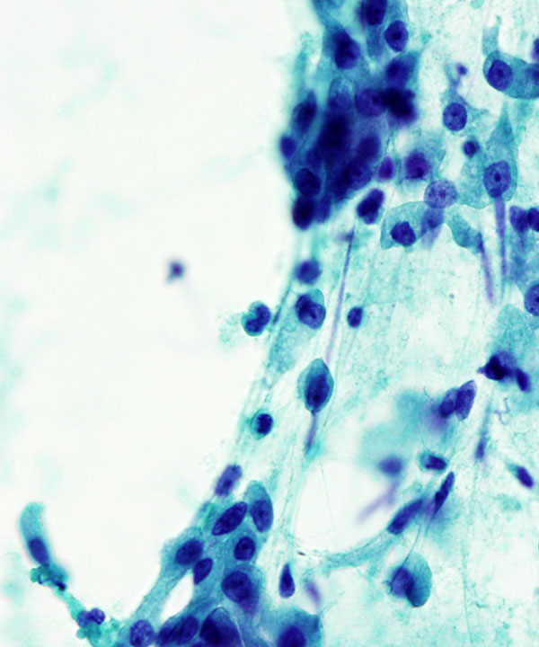 07 : Salivary Gland MASC