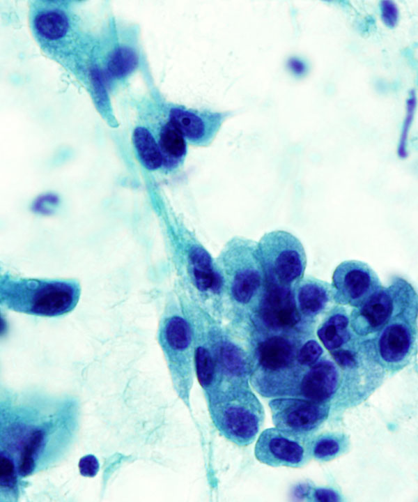 09 : Salivary Gland MASC