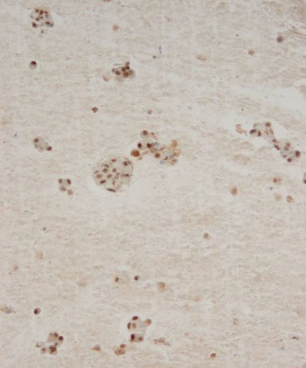 13 : Salivary Gland MASC