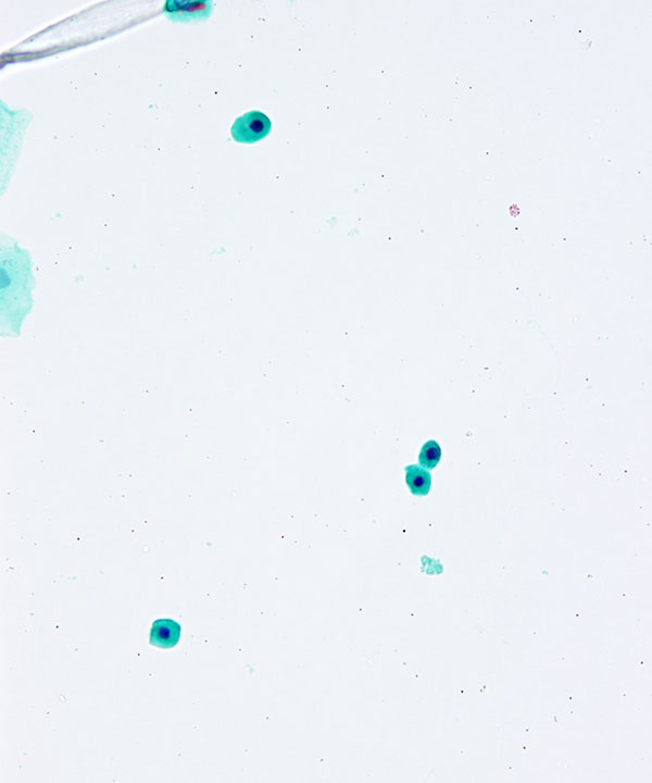 2 : Urine Normal Urine